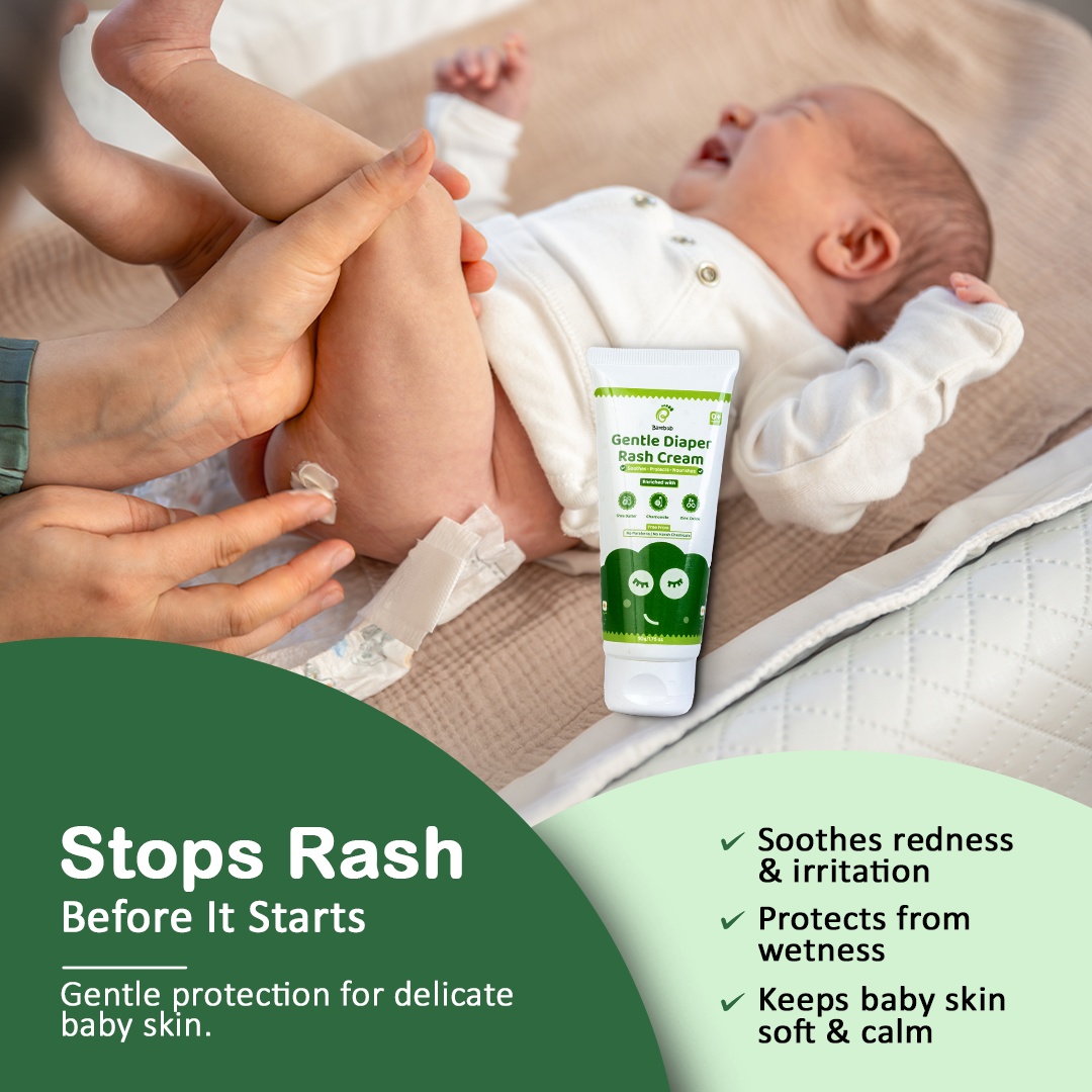 Baby with diaper rash being treated with a tube of Gentle Diaper Rash Cream.